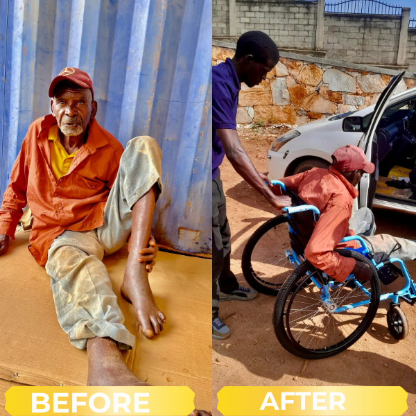 Before and after wheelchair support case 2